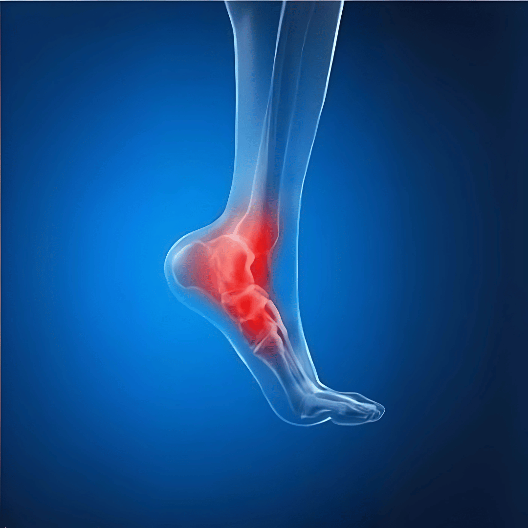Foot and Ankle Problems