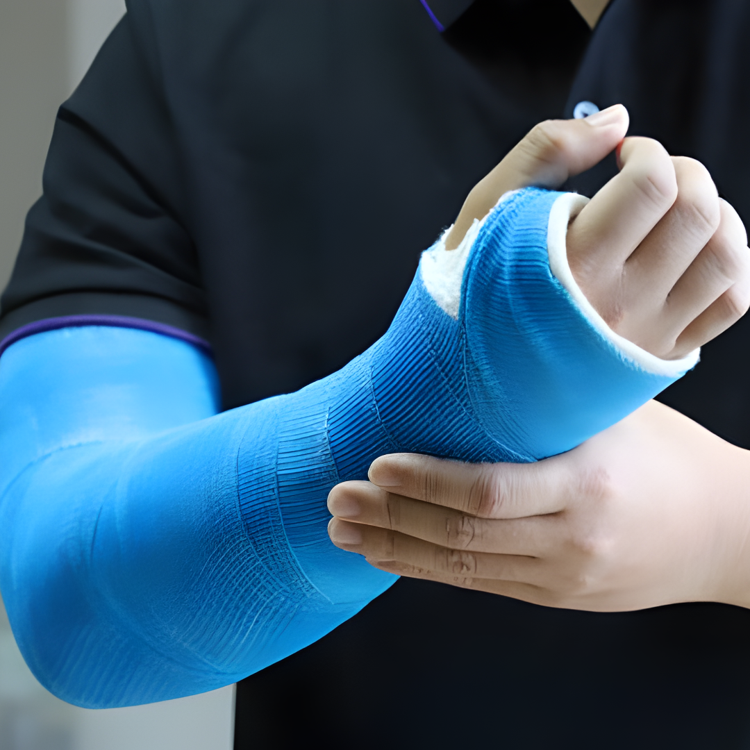 Adult Fractures, Sprains