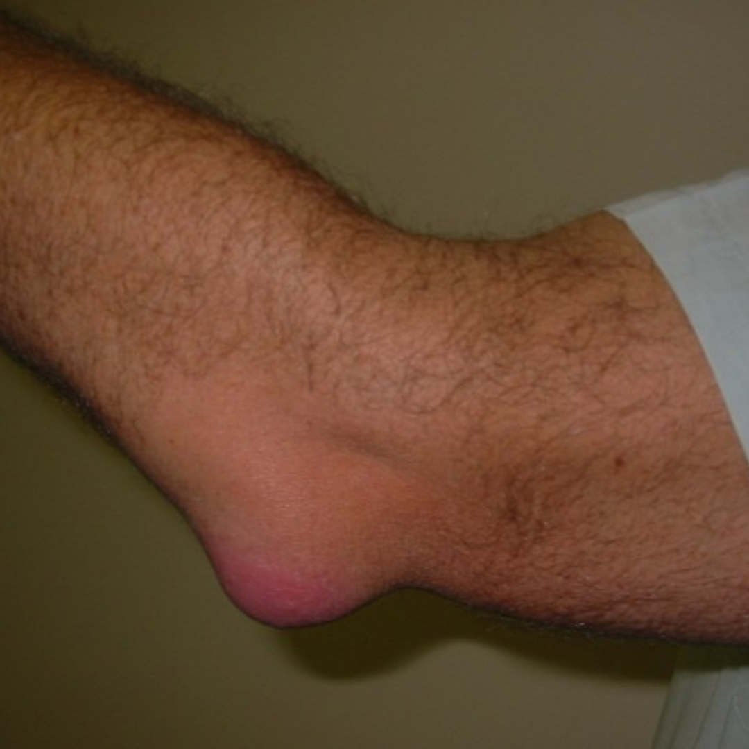 Hand, Wrist, Elbow Problems