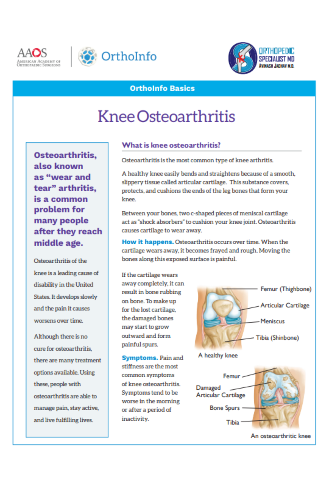 knee-osteoarthritis