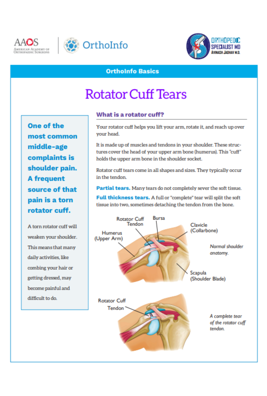 rotator-cuff-tears