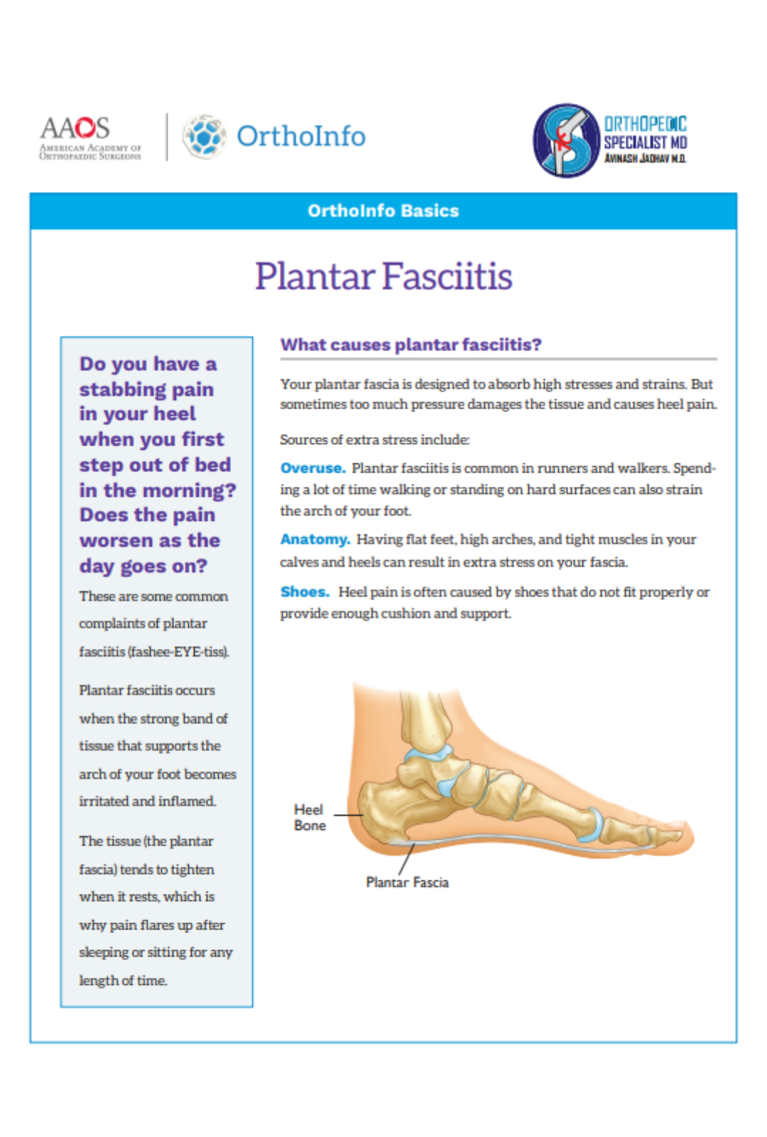 planter-fasciitis