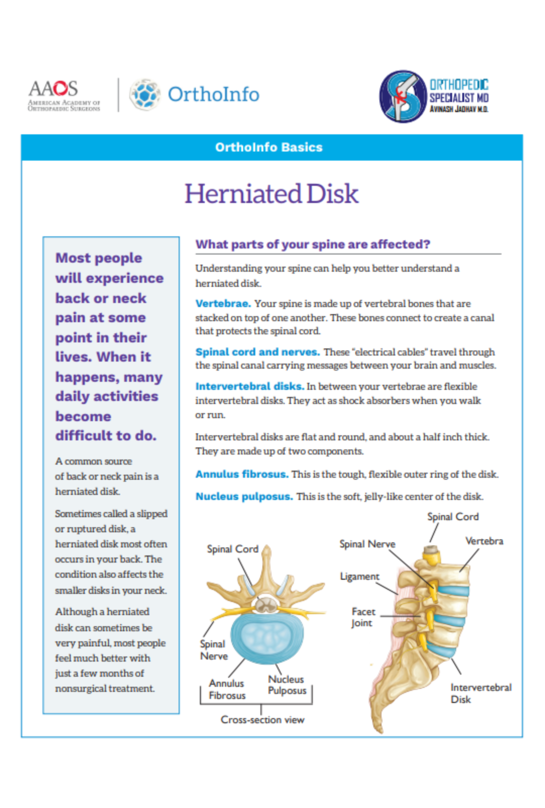 herniated-disk