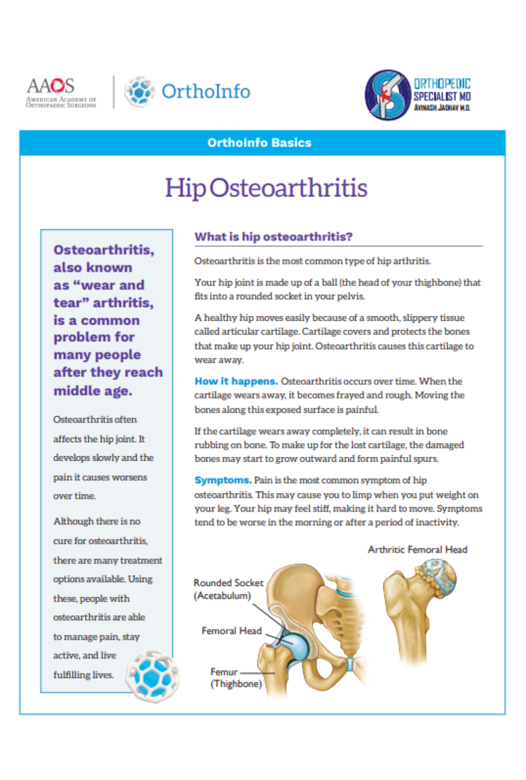 hip-osteoarthritis