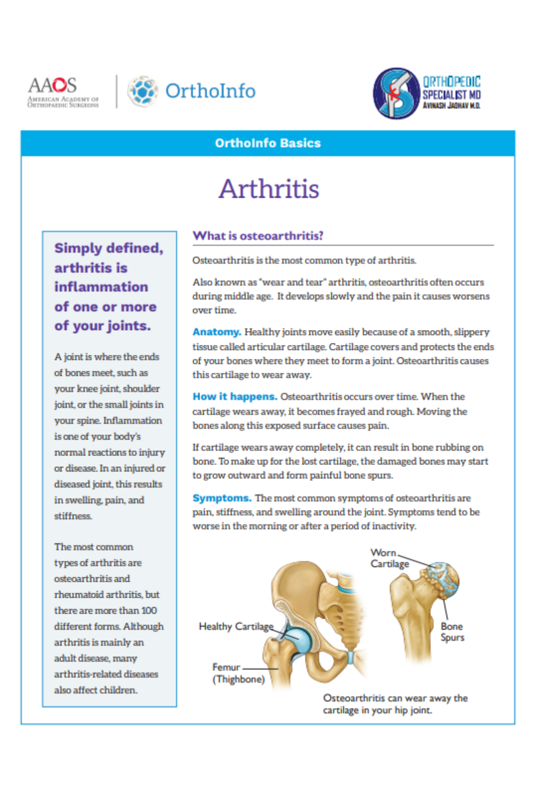 arthritis