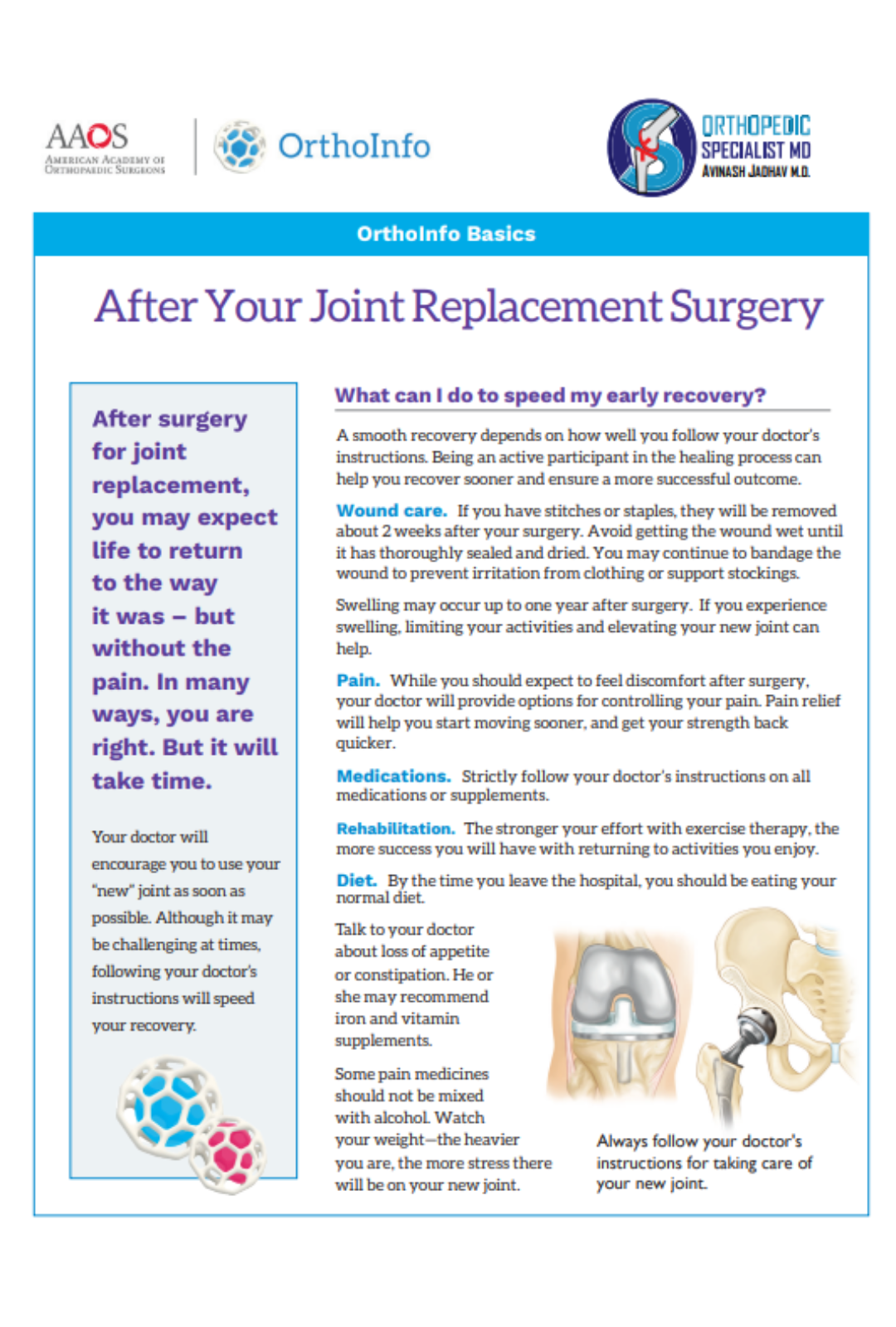 after-your-joint-replacement-surgery